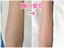 ディオーネ 新潟けやき通り店(Dione)の雰囲気（【落ち着いた完全個室】お肌やボディのご相談しづらいお悩みも◎）