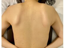 マホラ 高崎駅東口店(Mahora)/あなたの肩甲骨は大丈夫！？