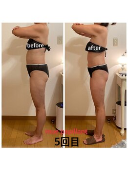 ミュー パピヤン(mue papillant)/ハイパーナイフEX&シェイプ全身