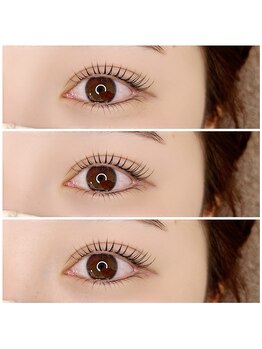 アイズ(i's)/上下ラッシュリフト