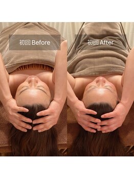 スリージー/before/after