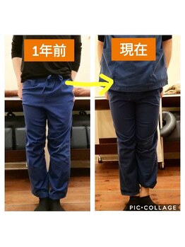 甲陽園鍼灸わたぐも/O脚改善
