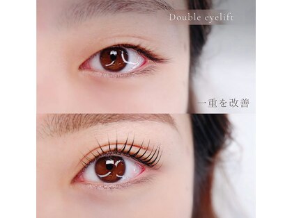 リット(LIT)の写真