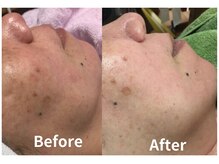 サロン デ ミロ(Salon de Miro)/BeforeAfter多数！ブログへGO♪