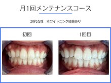エクシアホワイトニング 岡崎店/低価格で確実に白くなるサロン★