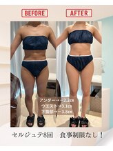 千歳の女神 久屋大通店/【施術風景】Berore/After