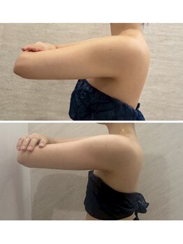 ルナグランデ 心斎橋店(Luna grande.)/ブライダルはお任せください