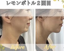 バーグトータルビューティー(bague total beauty)