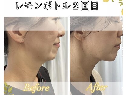 バーグトータルビューティー(bague total beauty)の写真