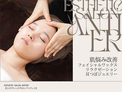 アンティエの写真