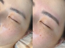 ルーヴェ(Luve)の雰囲気（眉毛ワックス＆耳つぼも人気です肌ケアと同時施術可能です）