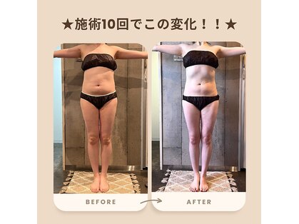 パーソナルデトックスサロン エヌ(N)の写真