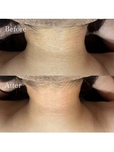 サロンベイア(salon Beia)/うなじワックス