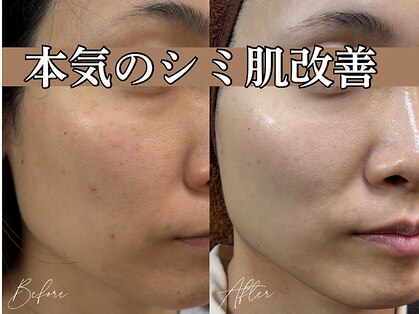 ジューンブライド(June Bride 61)の写真