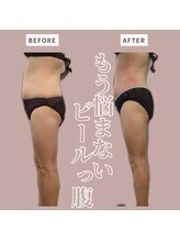 ソワン 小岩店(Soin)/60代　お腹