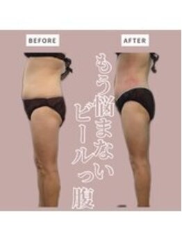 ソワン 小岩店(Soin)/60代 お腹