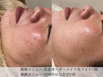 リエイト(Lieto)の写真/【シミしわ毛穴ケアもおまかせ♪】鏡をみて自分のお肌に溜息。頑張っても隠れない長年のお悩みを解決！