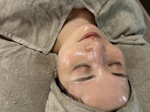 サロン カレナ(salon KARENA)の雰囲気(当サロンでの変化!ワンランク上の圧倒的美肌に!)