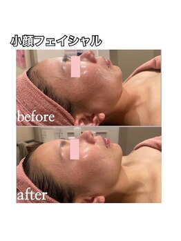 エステティックレイビス 名古屋店(RAYVIS)/小顔フェイシャル