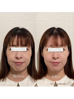 エクボ 立川店(EKUBO)/