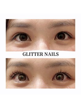 グリッターネイル(GLITTER NAILS)/セラムラッシュリフト