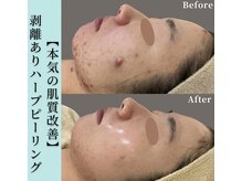 透肌美(トウキビ)