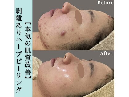 透肌美(トウキビ)の写真