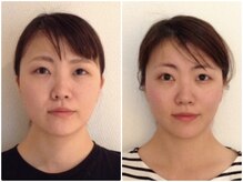 美容整体ウェリナ あま甚目寺院/小顔矯正/骨盤矯正/美脚サロン