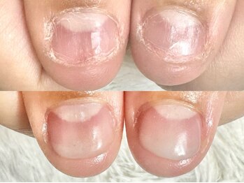 グラシナ なんば店/深爪/噛み/むしり癖/長さだし