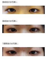 アロマスイーツ(AromaSweets)/7週間後のまつげパーマはこちら