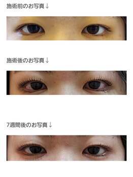 アロマスイーツ(AromaSweets)/7週間後のまつげパーマはこちら