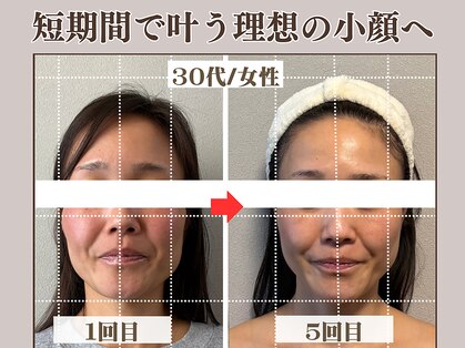 コガオラボ 甲府店(KOGAO LABO)の写真