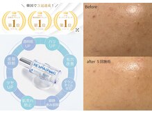 シエルフチュール(CielFutur)の雰囲気（韓国人気ピーリングを呉市で♪）