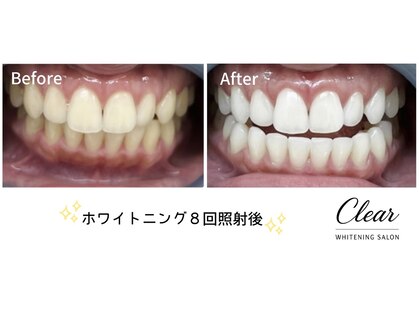 クリア(Clear)の写真