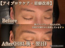 ボディリカバリー(Bodyリカバリー)/
