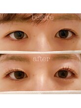 アディクト 恵比寿店(ADDICT)/左右差がある方もご相談下さい☆