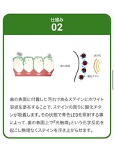 リセット 橋本店(Re Set)/セルフホワイトニング