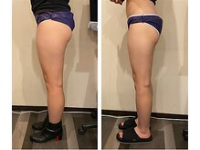 エルモソ(Hermoso)/美尻へ導く　痩身