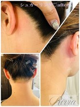 レビア(Revia)/◇人気のうなじシュガーリング◇