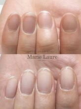 マリーロール 天王寺店(Marie Laure)/自爪育成/深爪矯正/ネイルケア