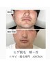 【青ヒゲ×ニキビ改善】ヒゲ脱毛＆毛穴集中ケア /越谷
