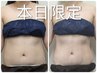 【衝撃価格！】☆上半身3部位集中ケア☆脂肪撃退マシン×骨盤矯正￥2,980