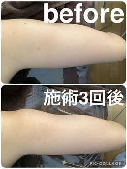 ギンザアール(GINZA R.)/