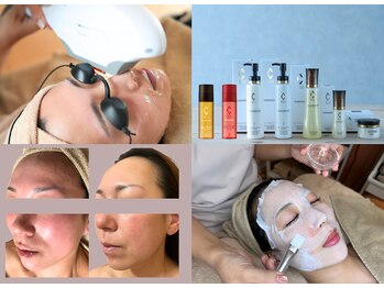 リスサロンドナース(LYS salon de Nurse)の写真/お肌の角質層～真皮層まで直接幹細胞を届ける[水光肌メソ導入]肌のお悩みに寄り添い土台から本格美肌ケア◎