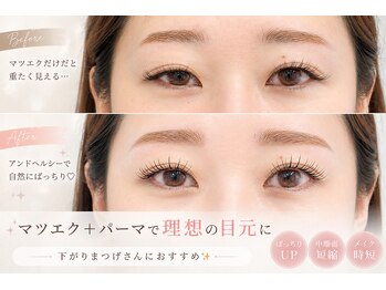 リム(Lim)の写真/《アンドヘルシー》マツエク×まつげパーマのいいとこ取り！
