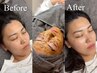 【当店人気No.1】美肌WAX+ハーブピーリング★100%国産ハーブで肌質改善