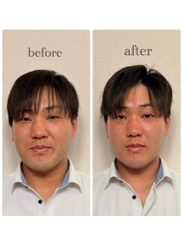 エアケア(AirCare)/男も肌で差をつける時代！