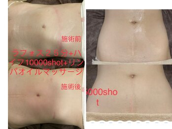 ドクタースタイル(Dr.style)/お腹もスッキリ♪