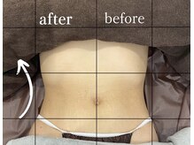 ウニ(uni)/BeforeAfter