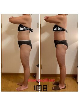 ミュー パピヤン(mue papillant)/ハイパーナイフEX&シェイプ全身